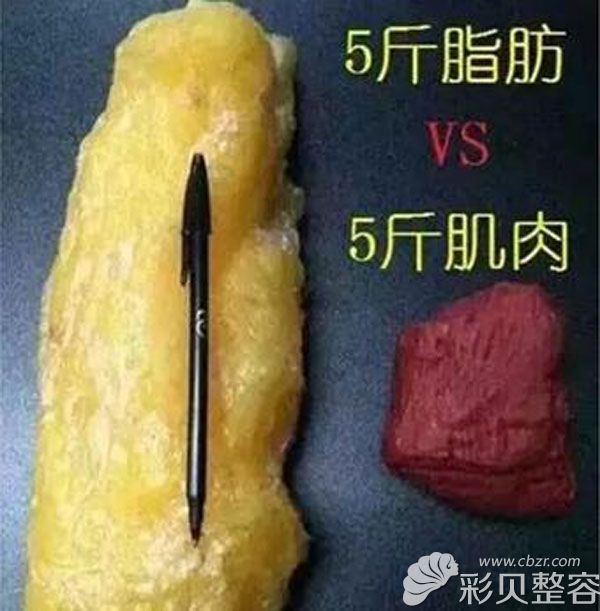 郑州吸脂整形